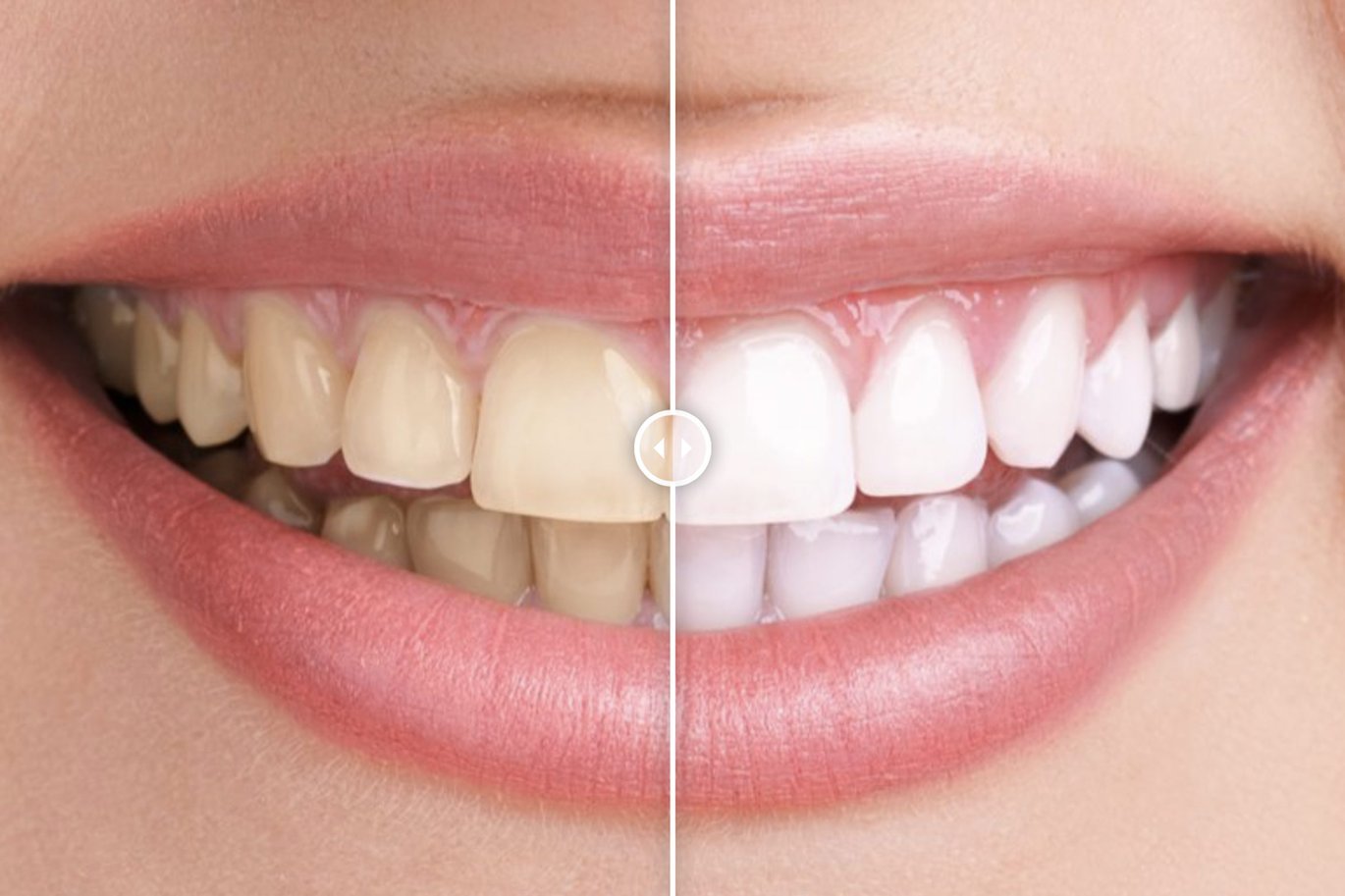 Before and After Image Compare for Elementor